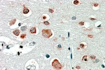 HAMP Antibody