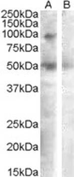 SFRP4 Antibody