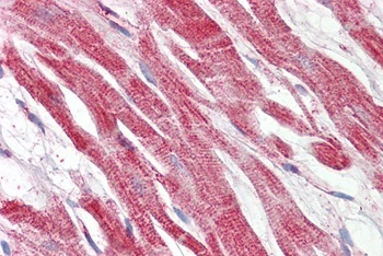 SFRP4 Antibody