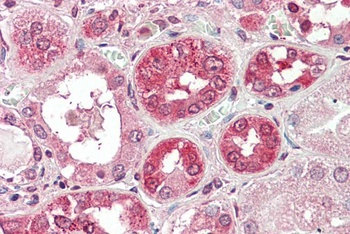 MTNR1B Antibody