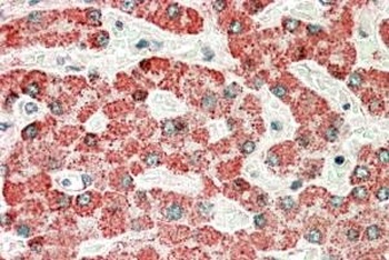 ITPKC Antibody