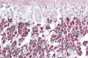 NUAK1 Antibody