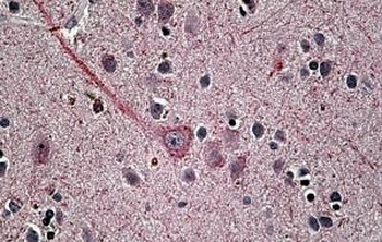 TMPRSS4 Antibody