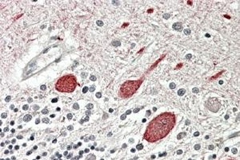 TNKS Antibody