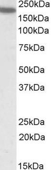 STK39 Antibody