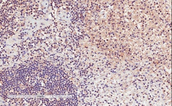 STK39 Antibody