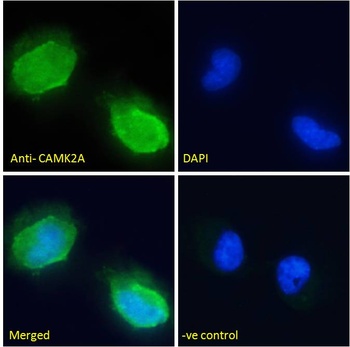 CAMK2A Antibody