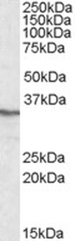 CAMK2A Antibody