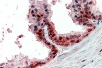 CAMK2A Antibody