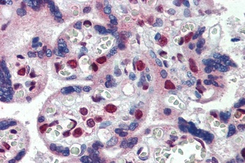 FMR1 Antibody