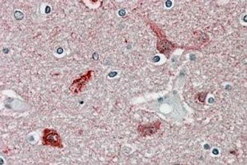 FMR1 Antibody