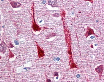 CRYM Antibody