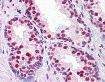 RUNX2 Antibody [1D2]