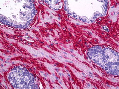 COL1A1 Antibody [3G3]
