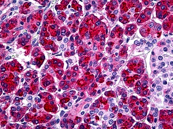 SPINK1 Antibody