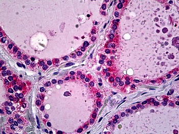 SFTPD Antibody
