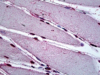 MEOX2 Antibody [6A5]