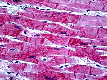 HSPB8 Antibody