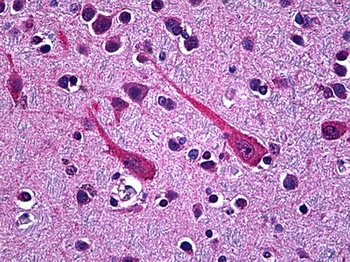 PCSK1 Antibody