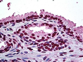 DLX2 Antibody