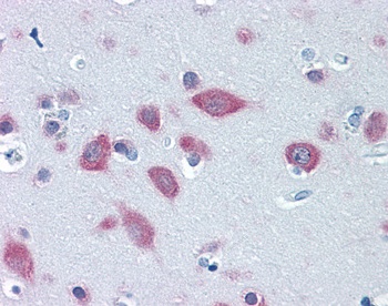 FARSB Antibody