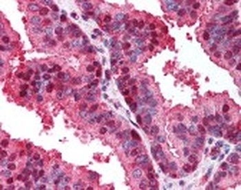 CDKN2A Antibody