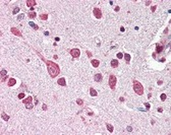 CUL7 Antibody