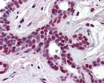 CUL3 Antibody