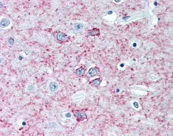 Adenosine A2a Receptor Antibody [7F6-G5-A2 / 7F6]
