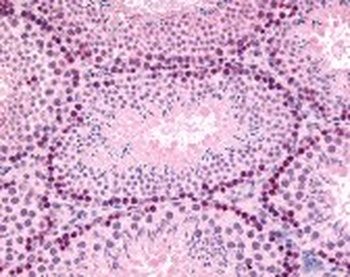 GLI2 Antibody