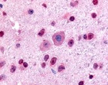GLI2 Antibody