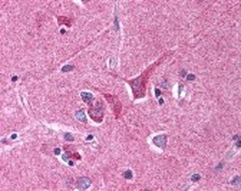 SLIT1 Antibody