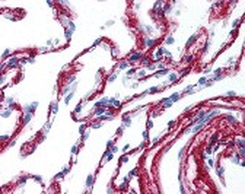 COL6A1 Antibody