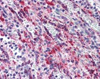 TGFB1 Antibody