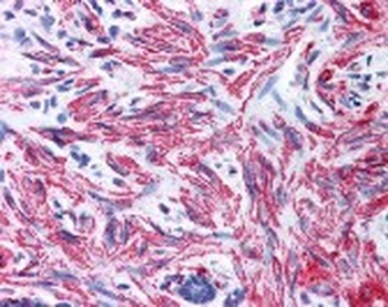 MYL9 Antibody