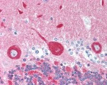 NCS1 Antibody