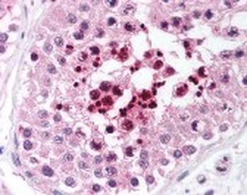 RIF1 Antibody
