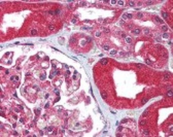 ABCB1 Antibody