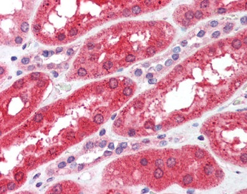 FGFR4 Antibody [53CT32.19.3]