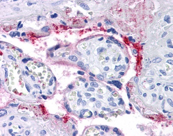 ITGB3 Antibody