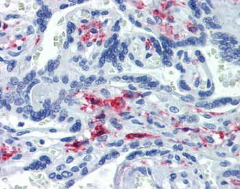 CD163 Antibody