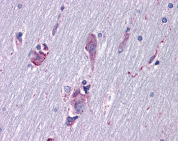 ISL1 Antibody