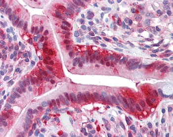 LDHA Antibody