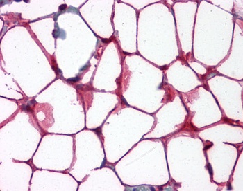 VCAM1 Antibody [6G9]