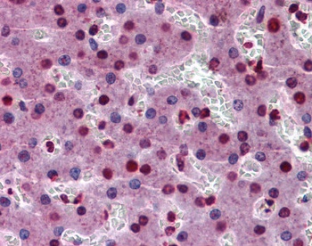 STAT3 Antibody