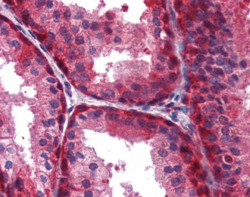 WNT5A Antibody