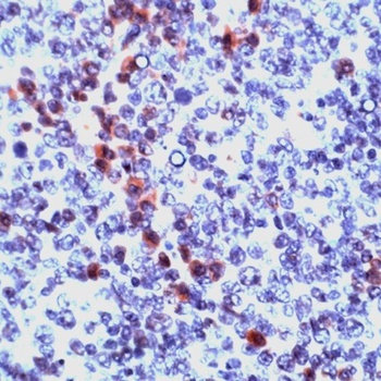 GZMB Antibody