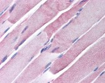 GOT1 Antibody
