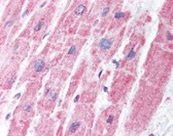 MDH1 Antibody