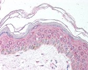 MDH1 Antibody